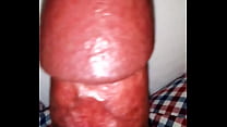 penis examination
